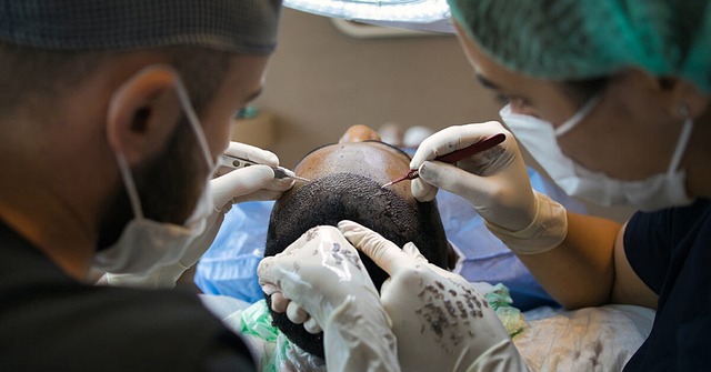 Få dit hår tilbage: Alt om moderne hårtransplantationer for mænd